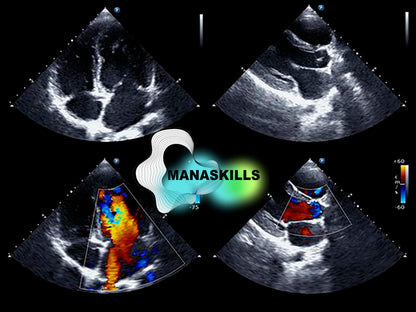 Master Cardiovascular Ultrasound (🇬🇧)