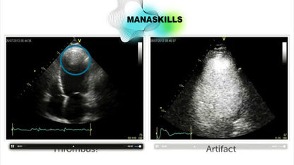 Ultimate Abdominal Ultrasound Course: Master Abdominal Ultrasound with Over 21 Hours of Expert Training (🇬🇧)