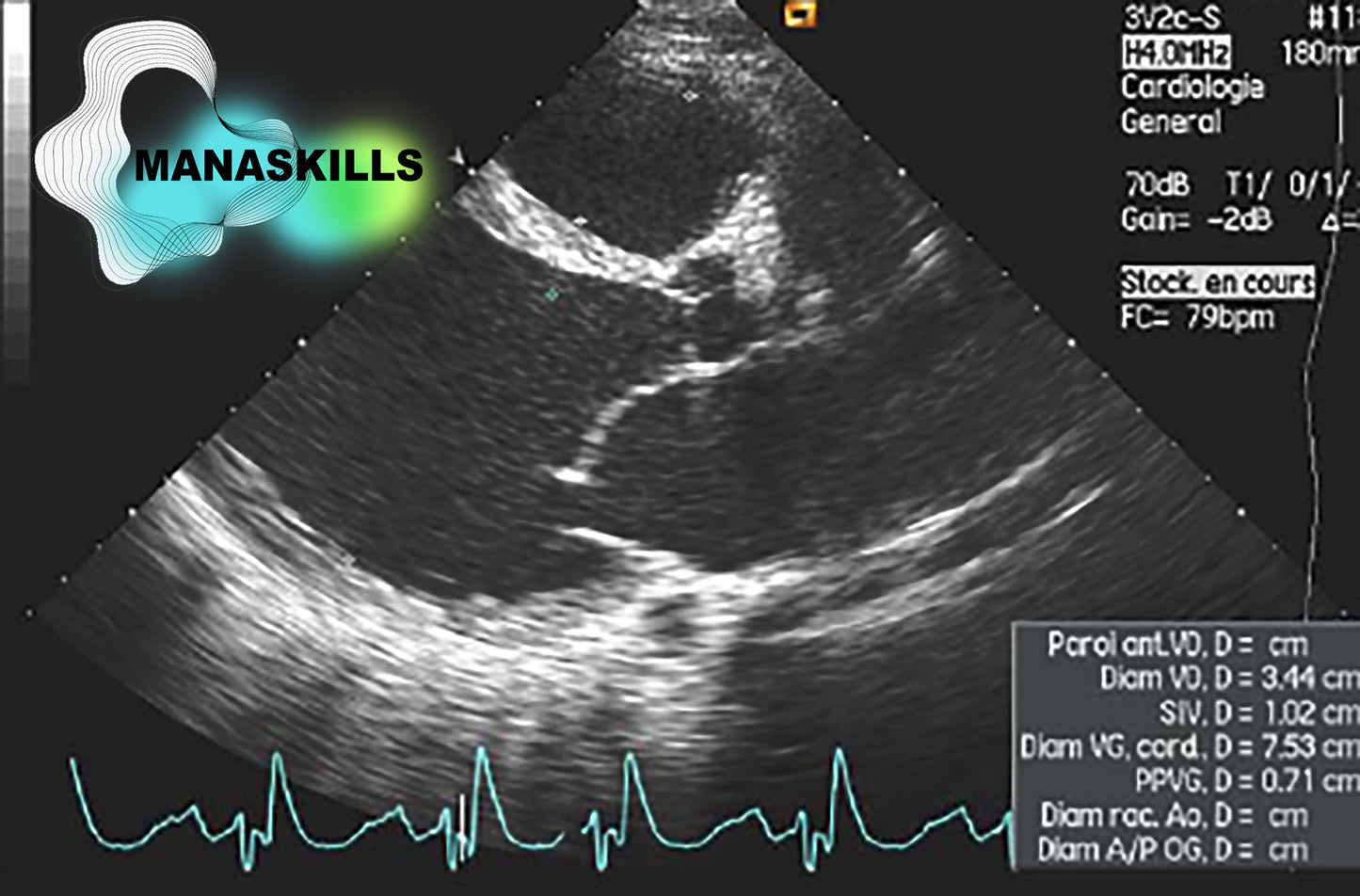 Master Cardiovascular Ultrasound (🇬🇧)