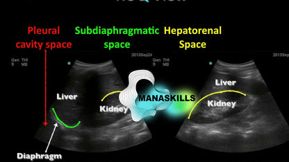 Ultimate Abdominal Ultrasound Course: Master Abdominal Ultrasound with Over 21 Hours of Expert Training (🇬🇧)